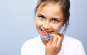 Braceless Choice | Early intervention dental treatment