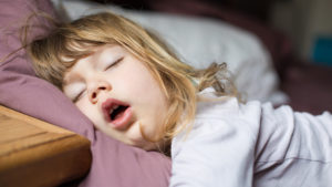 Snoring and sleep apnoea in children